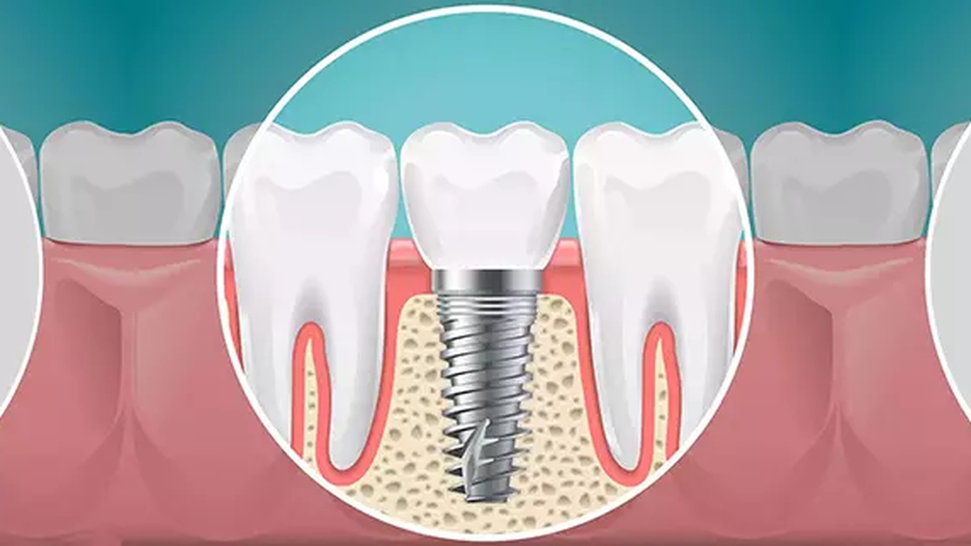 Uzman Eller, Güvenli Tedavi